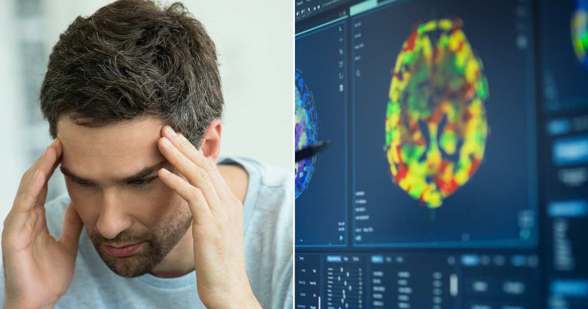 (L) Man experiencing a headache. (R) A brain scan. Representative Cover Image Source: Getty Images | Eric Audras; gorodenkoff