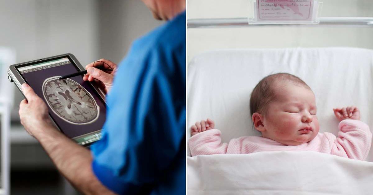 (L) A doctor looking at a person's brain scan. (R) A baby sleeping in a hospital crib. Representative Cover Image Source: Getty Images | Solskin; Catherine Delahaye
