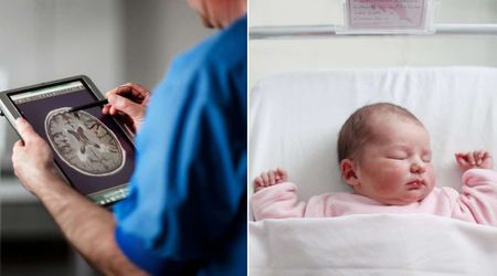 Baby was given weeks to live due to brain disorder—a patient's selfless act gave the baby a second chance at life
