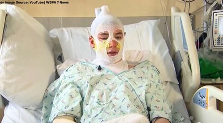 Uncle survived third-degree burns after running into burning building to save little niece—what he said in hospital stunned all