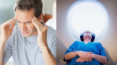  Dad never got proper diagnosis for his severe headaches—then a car crash finally led to life-saving MRI