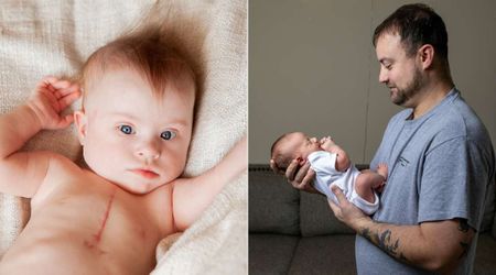 Infant had multiple surgeries that left huge scars—dad’s gesture of support is one that will bring tears to your eyes