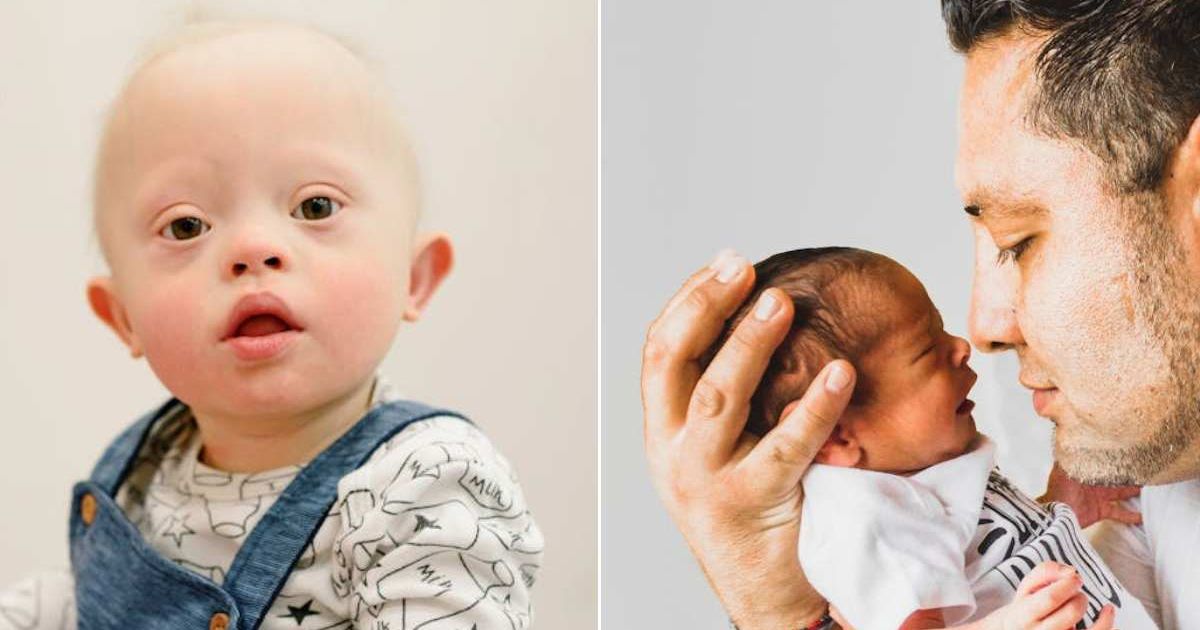 (L) Baby with Down syndrome looking ahead. (R) Dad holding newborn baby. Representative Cover Image Source: Pexels | Ksenia Chernaya; Laura Garcia