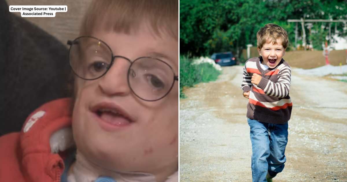 (L) William Tuckwell, a 7-year-old with Treacher-Collins Syndrome. Cover Image Source: Youtube | Associated Press (R) A little boy running happily. Representative Cover Image Source: Pexels | Luna Lovegood