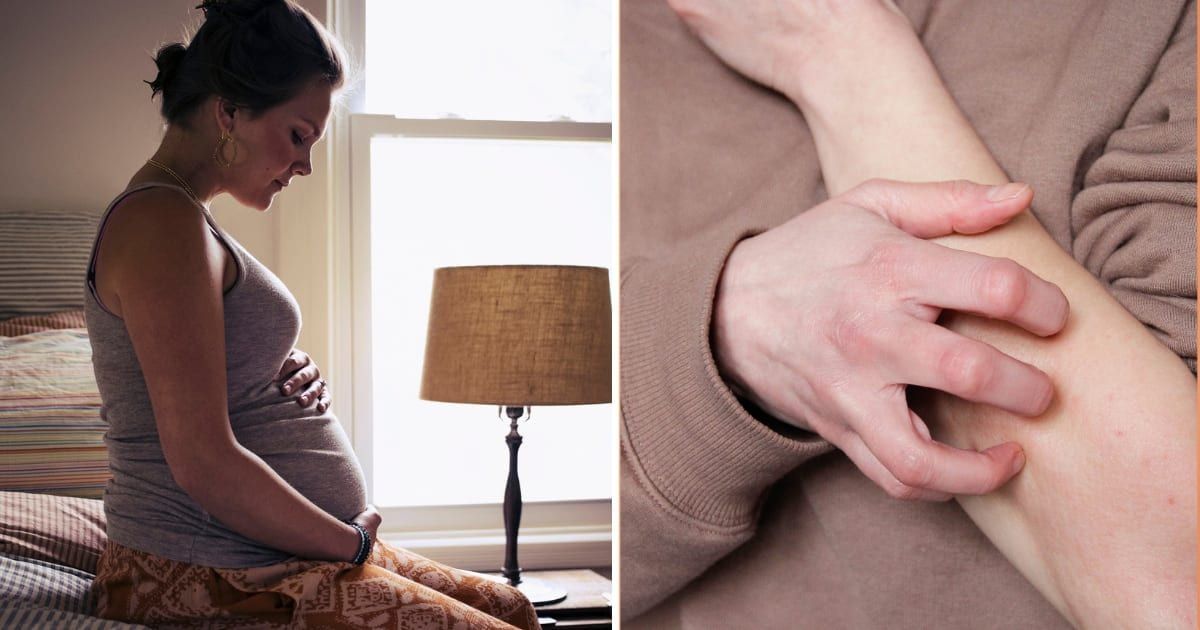 (L) A pregnant woman; (R) Female hands scratching (Representative Cover Image Source: GettyImages | Photo by (L) The Good Brigade; (R) stock photo) 