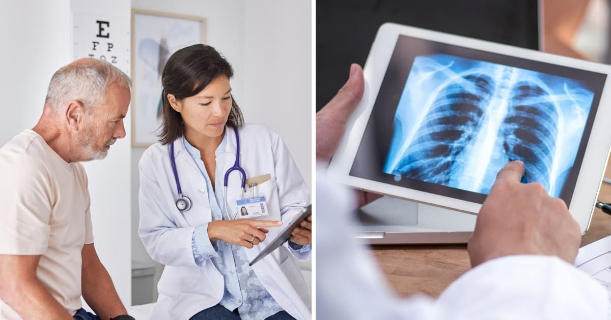 (L) A doctor explaining test results to patient; (R) Doctor analyzing lung screen reports (Representative cover image source: Getty | Photo by (L) Morsa Images; (R) athima tongloom)