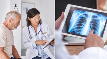 A routine screening led to a healthy 60-year-old losing one-third of his right lung — but the unexpected diagnosis gave him a second chance