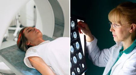 Doctors ruled out surgery for her ‘golf-ball-size’ brain tumor with only 50-50 chance— her one-year scan made them do a double take