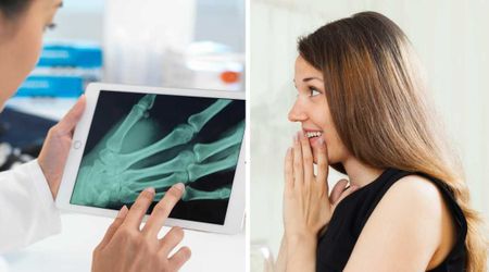 Her boyfriend convinced doctors to call her in for an X-ray after her broken wrist exam — then a tiny detail on one finger stopped her cold