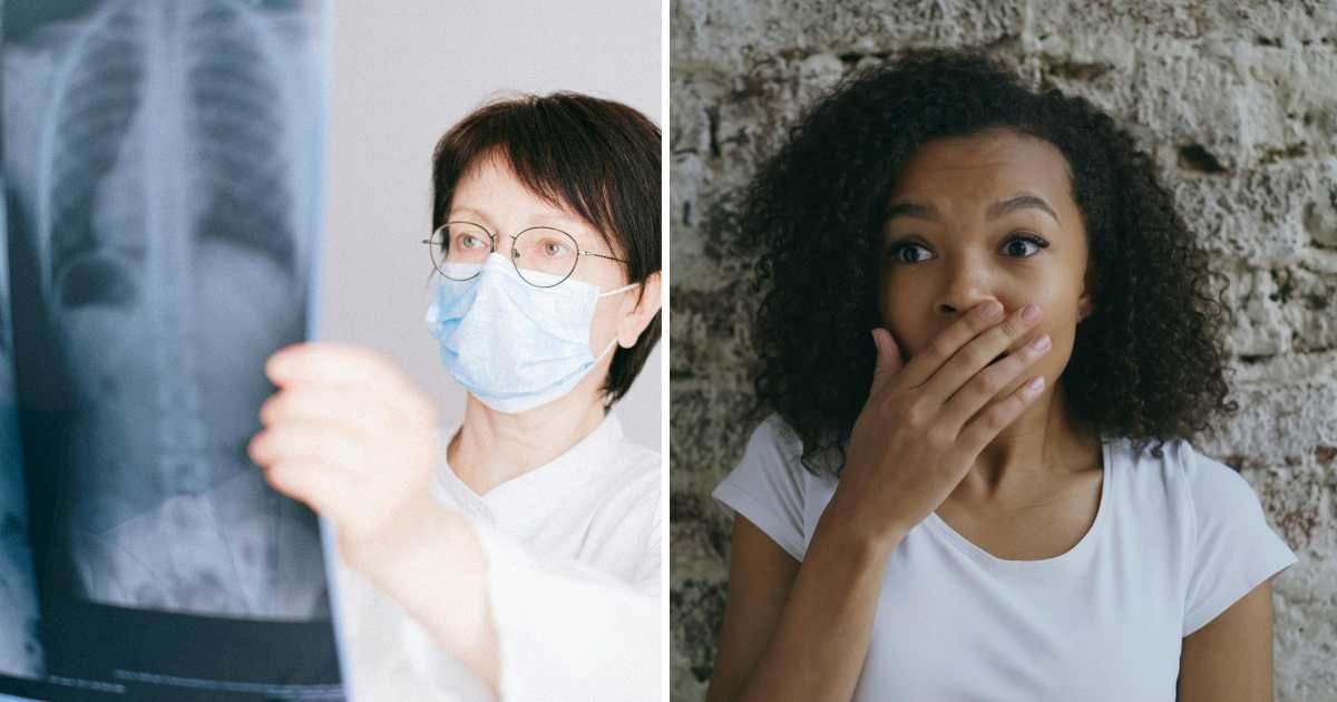 (L) Doctor checking scan report. (R) Woman shocked. (Representative Cover Image Source: Pexels | (L) Anna Shvets, (R) Vitaly Gariev)