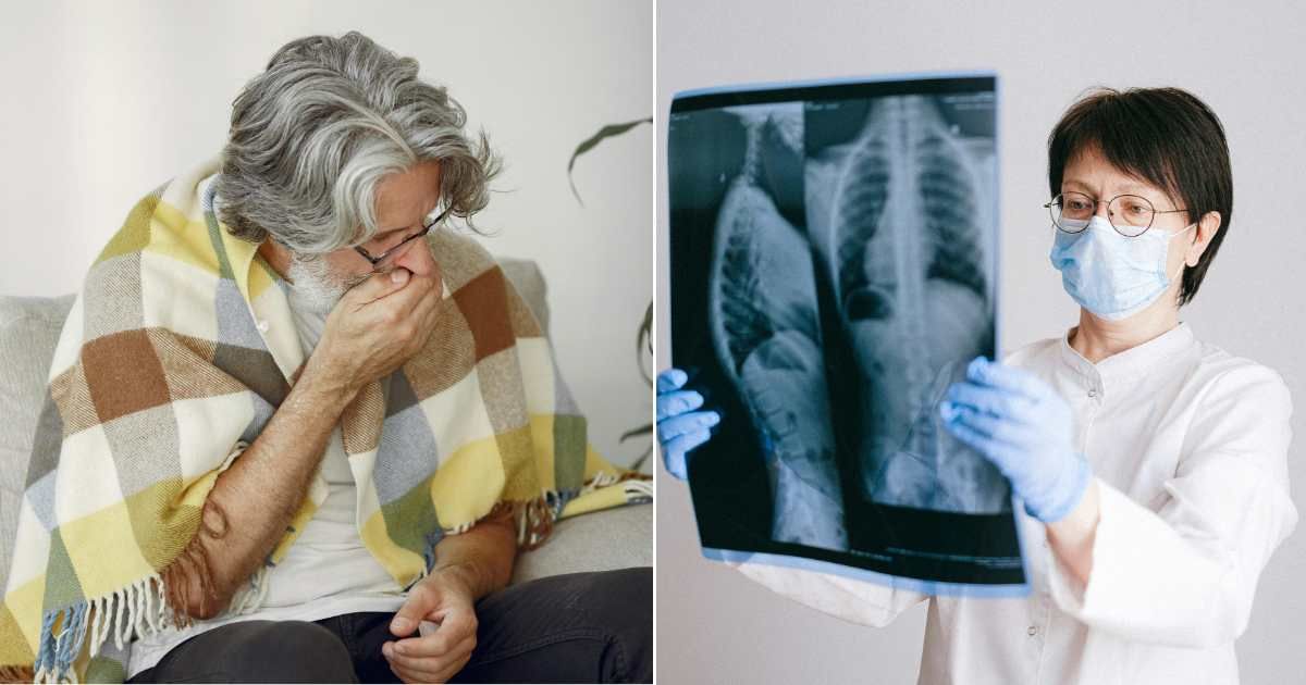 (L) An old man coughing (R) A doctor examining chest X-ray scan (Representative Cover Source: Pexels | (L) Gustavo Fring; (R) Anna Shvets)