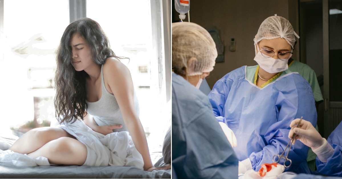 (L) A woman having stomach pain (R) Doctors performing surgery (Representative Cover Source: Pexels | (L) Andrea Piacquadio; (R) Jonathan Borba)