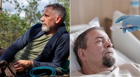 Man thought a thorn ‘punched’ his leg by the river—when his eyes turned red, his wife rushed him to the hospital and what doctors found froze them