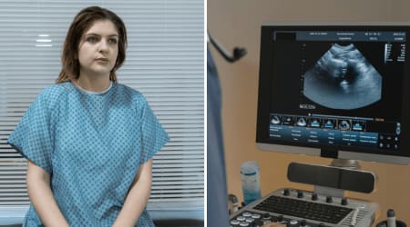 Doctors kept giving 19-year-old laxatives for what they thought was constipation — months later, surgeons had to cut her from sternum to pelvis